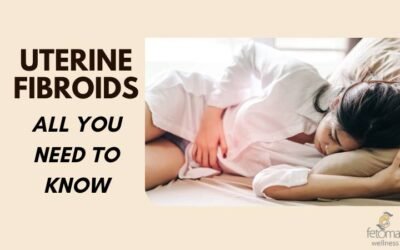 Uterine Fibroids: All You Need to Know