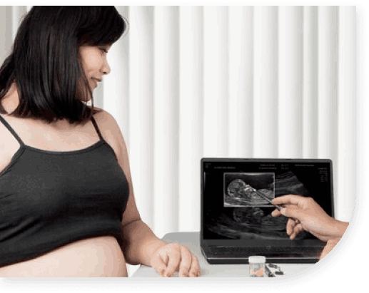 volume-4d-ultrasound-in-pregnancy