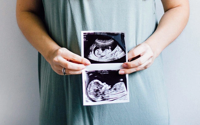 How Ultrasound Helps Monitor Pregnancy